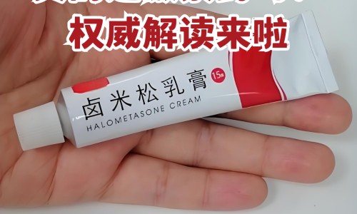 脸上头发油是什么原因怎么办网- 头上脸上出油严重是什么原因知识,分享脸上头发油是什么原因怎么办女性